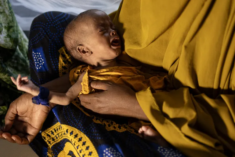 En nyligen fördriven somalisk kvinna håller sitt svårt undernärda barn på ett stabiliseringscenter för barn som lider av allvarlig undernäring i Kismayo,